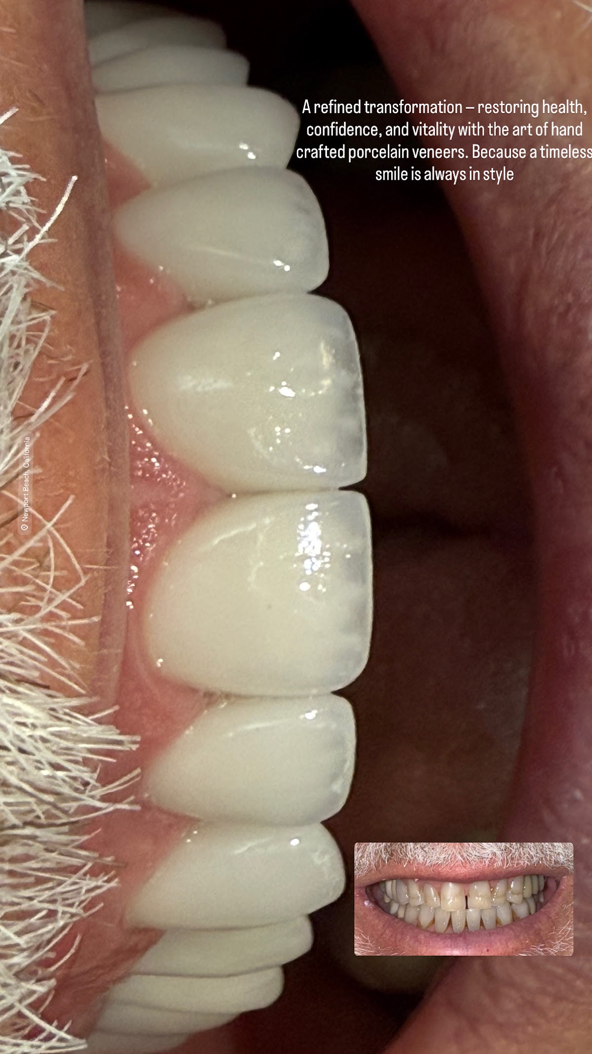 Palani Center For Dental Implants photo 3