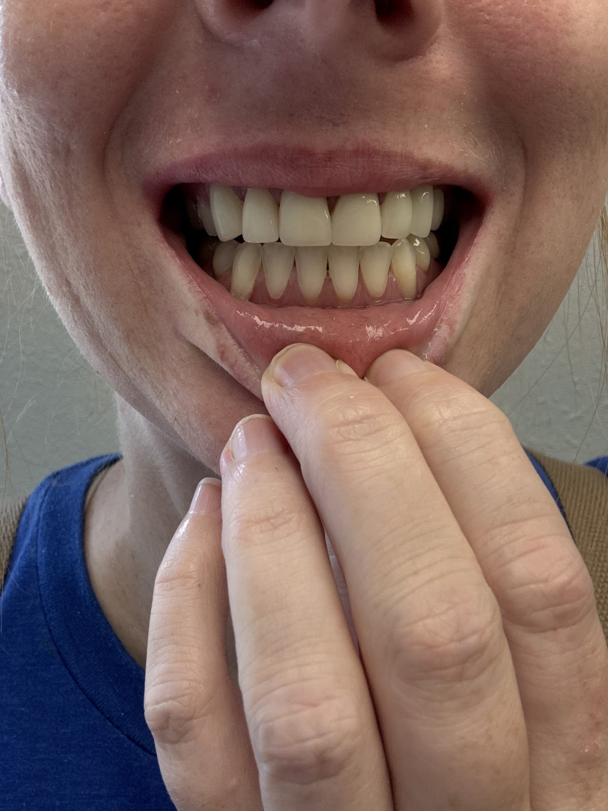 Sonria Dentista of Paris- Dental Implants and Family Dentistry photo 6