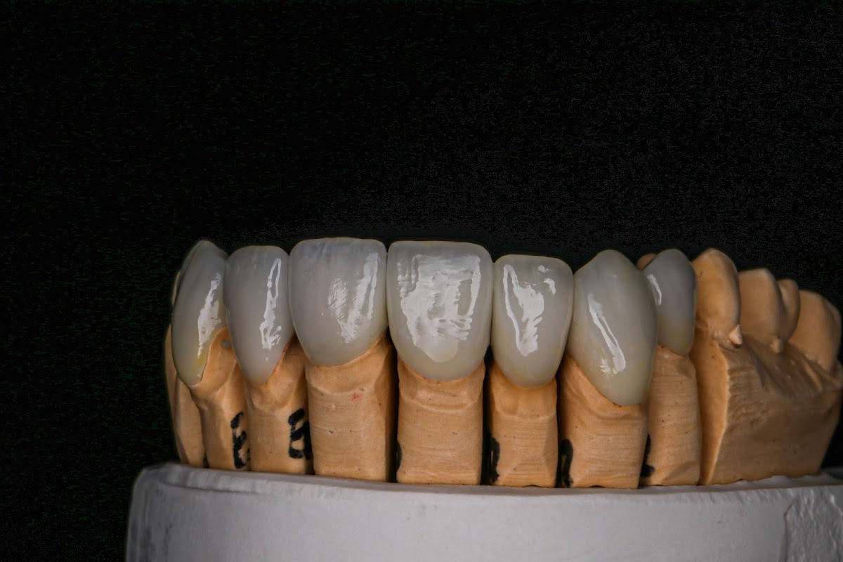 Intelligent Touch Dental Laboratory photo 3
