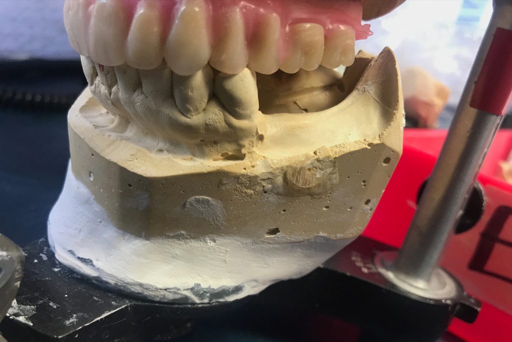 Intelligent Touch Dental Laboratory photo 4