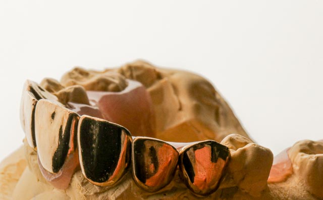 Intelligent Touch Dental Laboratory photo 5