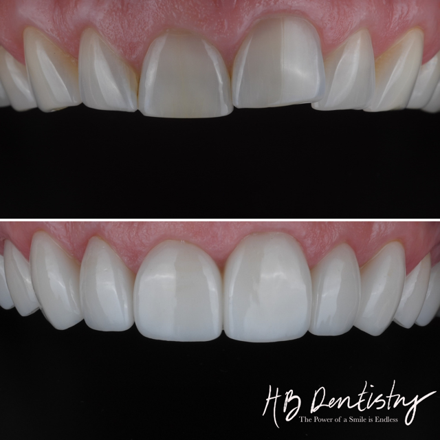 Hinrichs & Buckley Dentistry - Dr. Mark Hinrichs & Dr. Kelsey Buckley photo 3