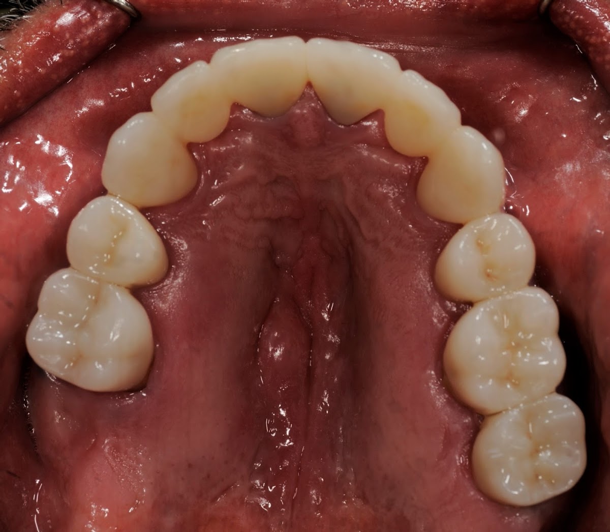 Hinrichs & Buckley Dentistry - Dr. Mark Hinrichs & Dr. Kelsey Buckley photo 5