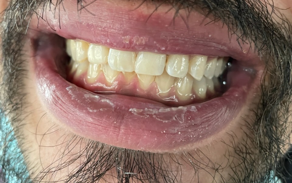Hood River Dental photo 4