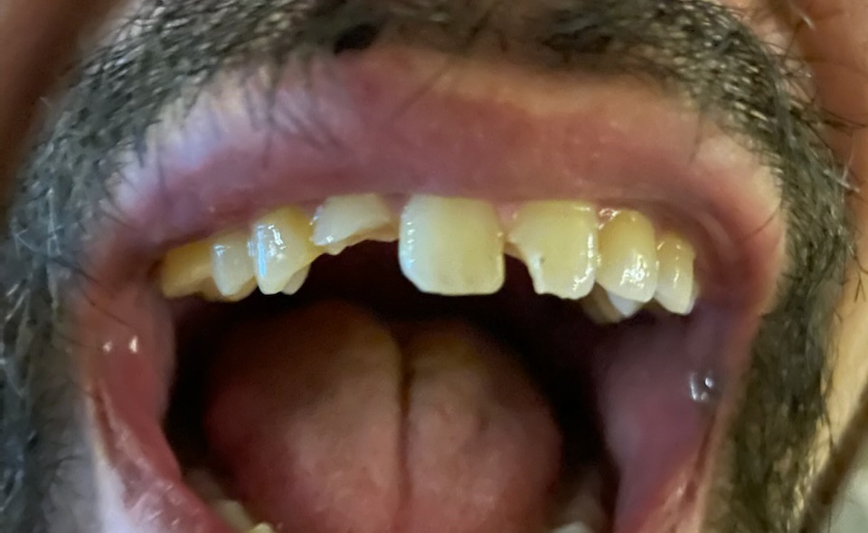 Hood River Dental photo 6