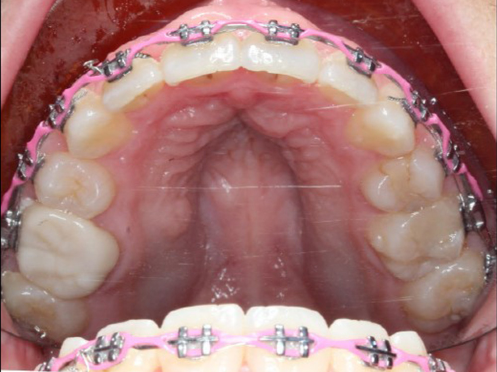 Normandy Dentistry photo 3