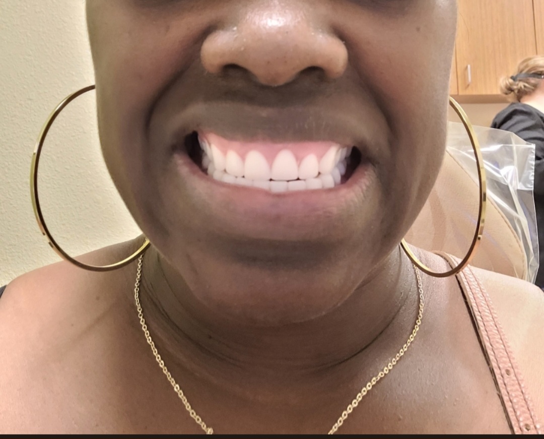 Affordable Dentures & Implants - Friendswood photo 5