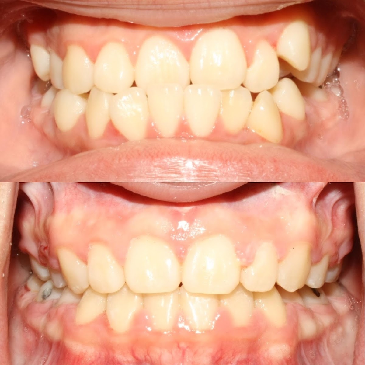 Upland Dental Implant And Orthodontics photo 2