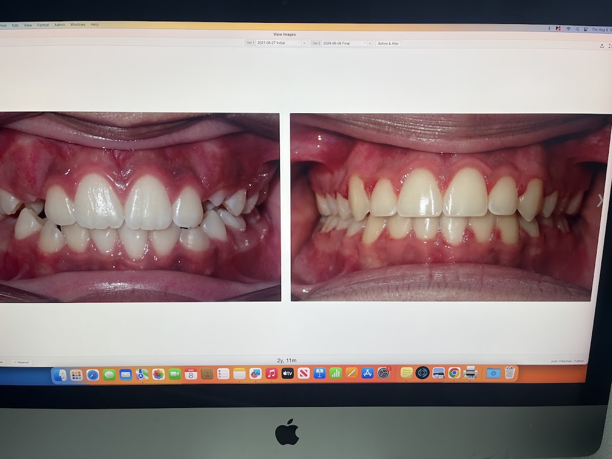 A Perfect Smile Orthodontics photo 3
