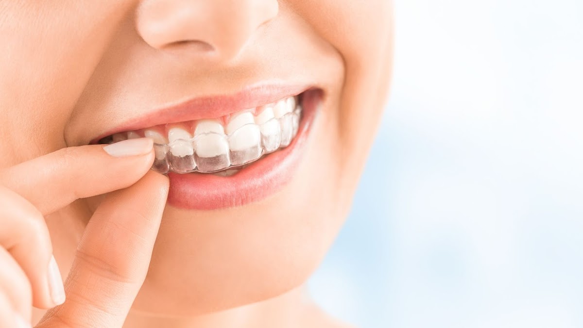 Ocean Dental - Comprehensive Dental Care in Hilton Head Island photo 4