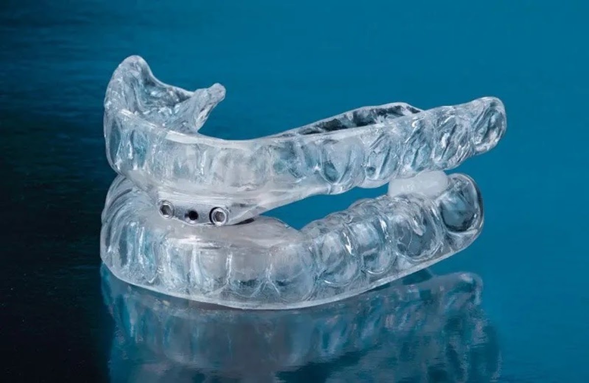 Ocean Dental - Comprehensive Dental Care in Hilton Head Island photo 5