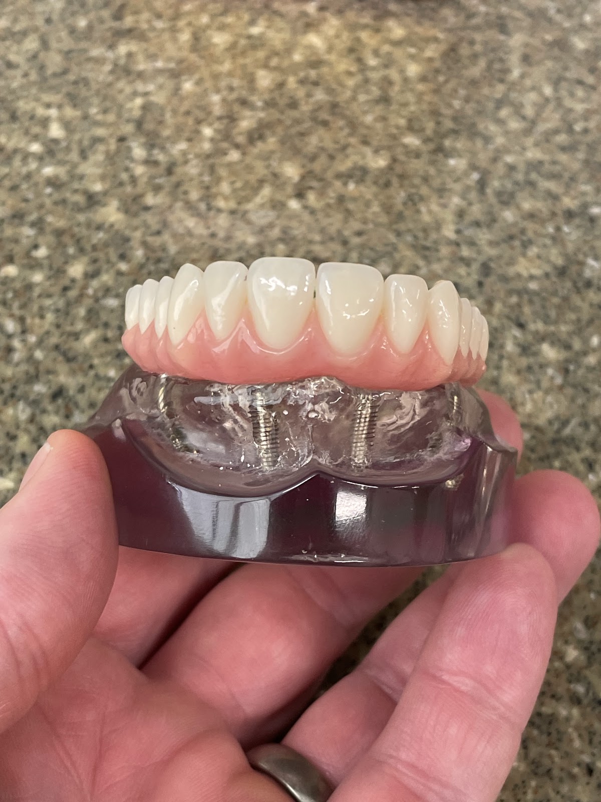 Dental Implant Aesthetic Center photo 2