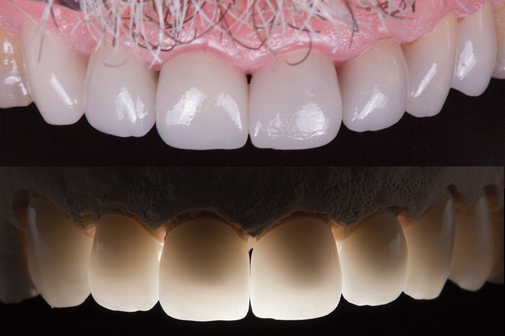 Express Dental Laboratory photo 2