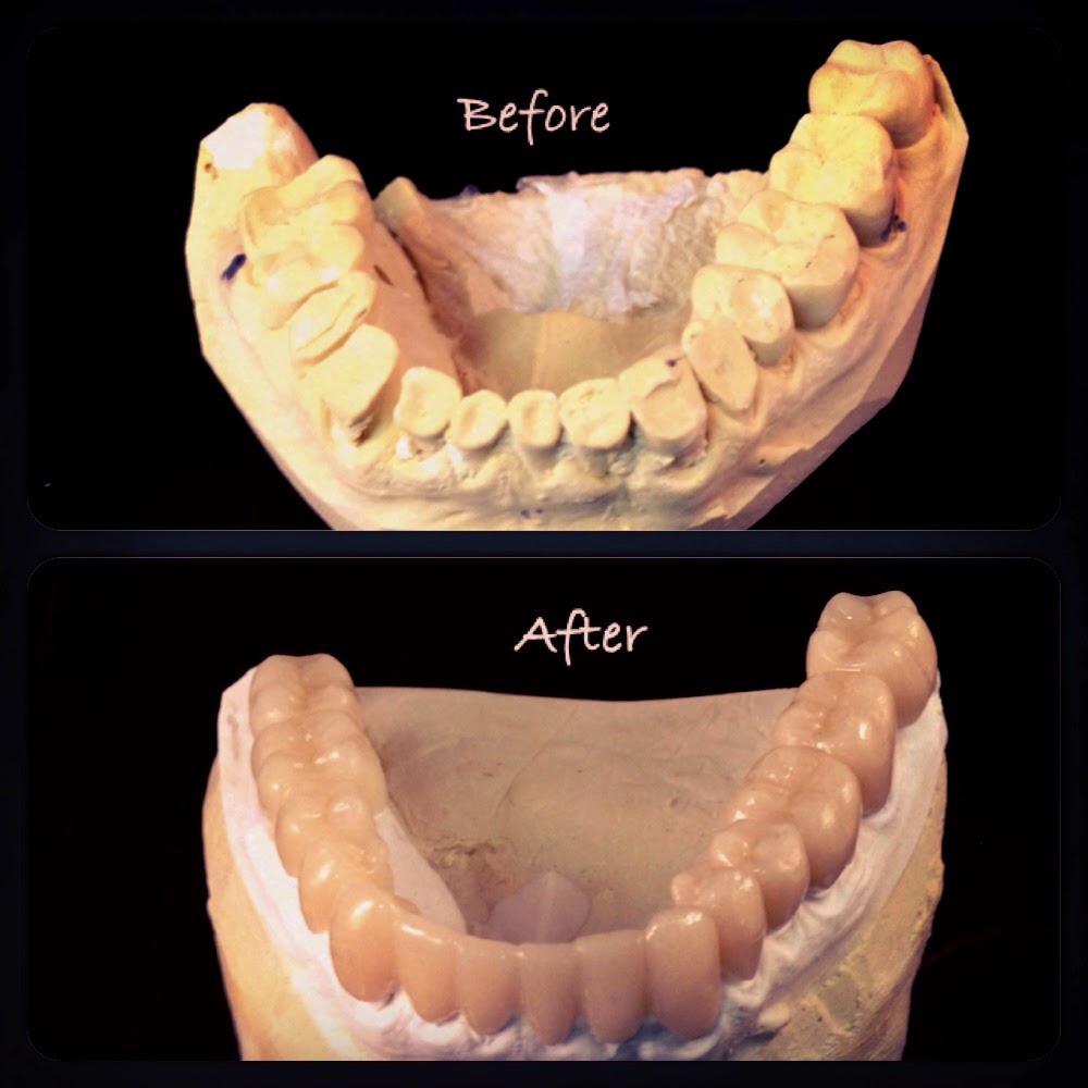 Express Dental Laboratory photo 4
