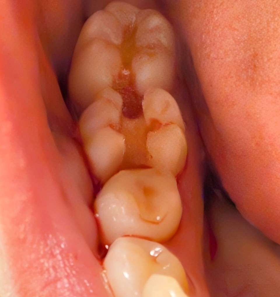 Aspen Dental - Pittsfield photo 4