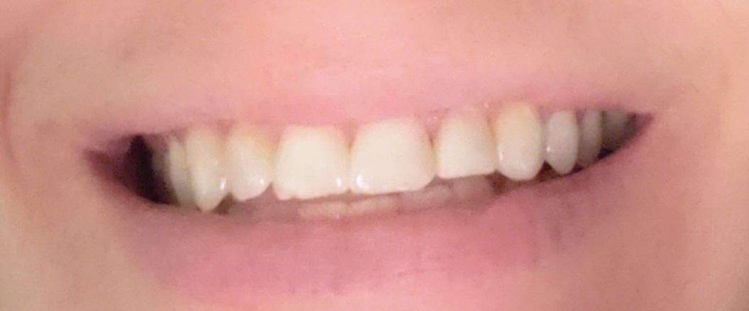 Aspen Dental - Pittsfield photo 5