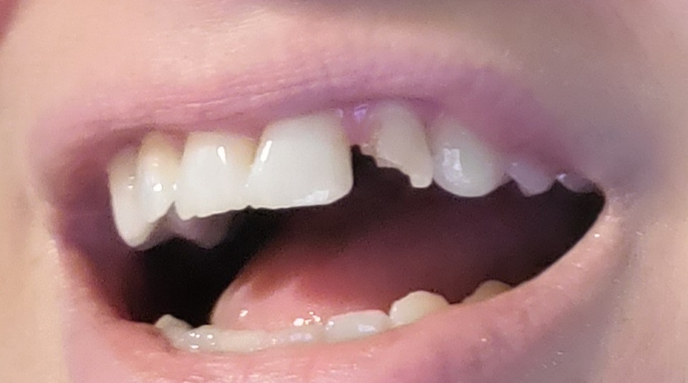 Aspen Dental - Pittsfield photo 6