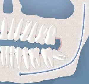 Oral Surgery and Dental Implant Center photo 2