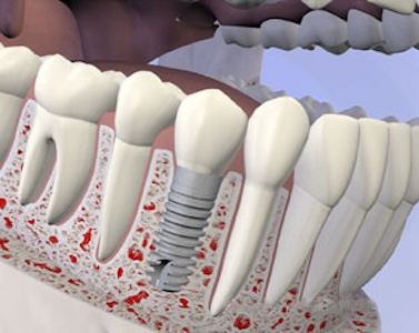 Oral Surgery and Dental Implant Center photo 3