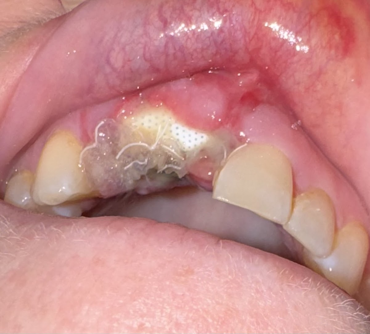 Westshore Periodontics and Dental Implants - North Olmsted photo 1