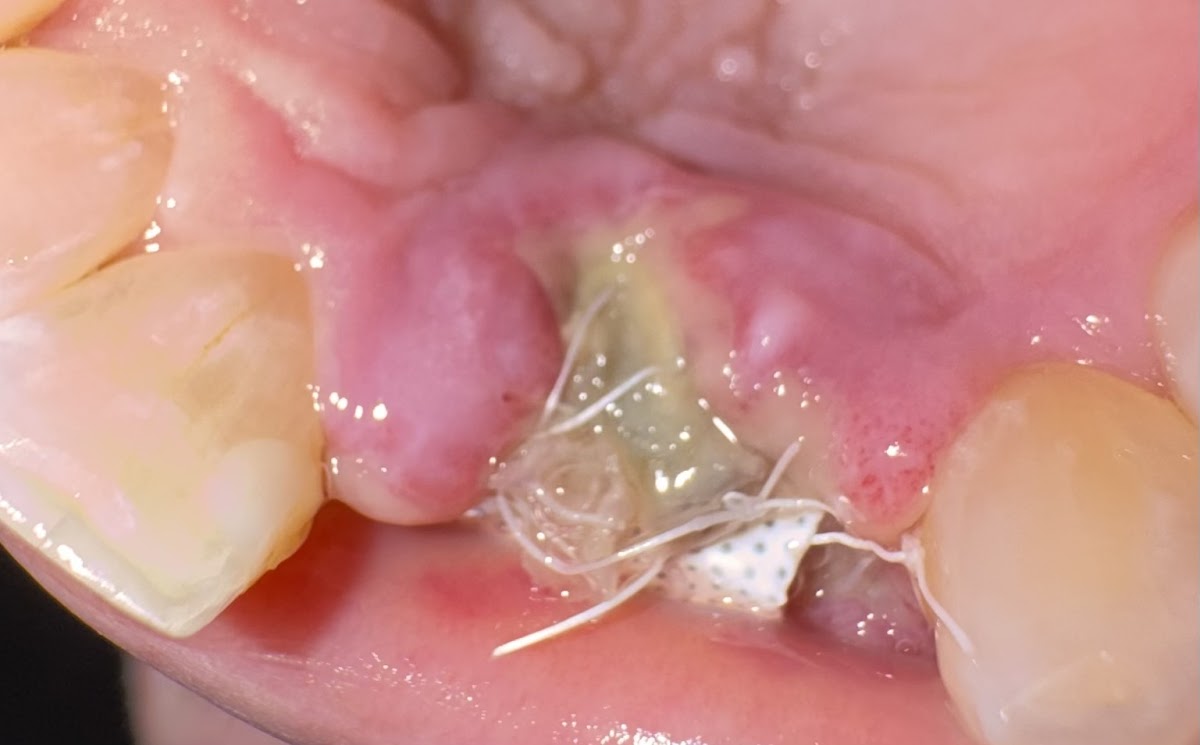 Westshore Periodontics and Dental Implants - North Olmsted photo 2