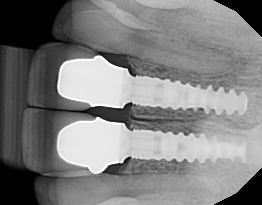 Idaho Dental Implants Lon C. Mcrae, DMD photo 2