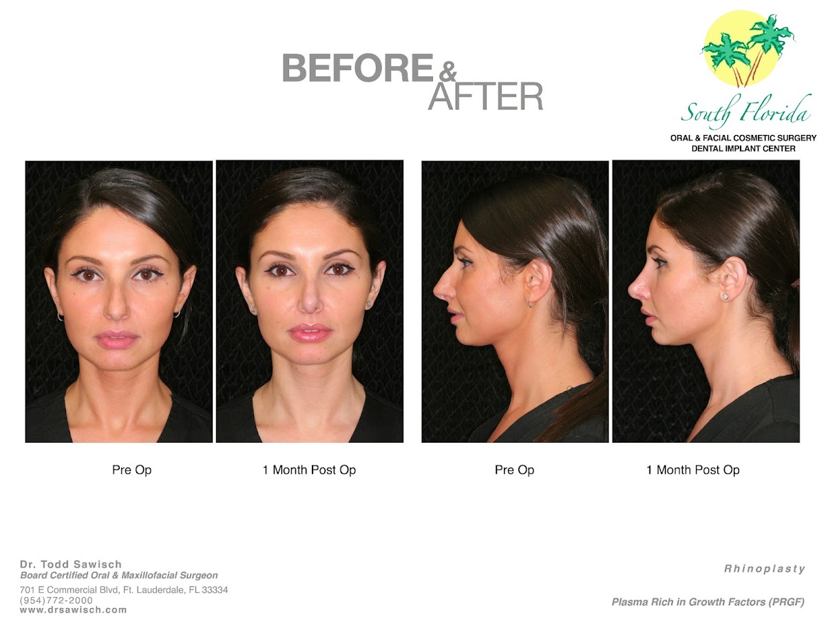 South Florida Oral & Facial Surgery | Dental Implant Center photo 4