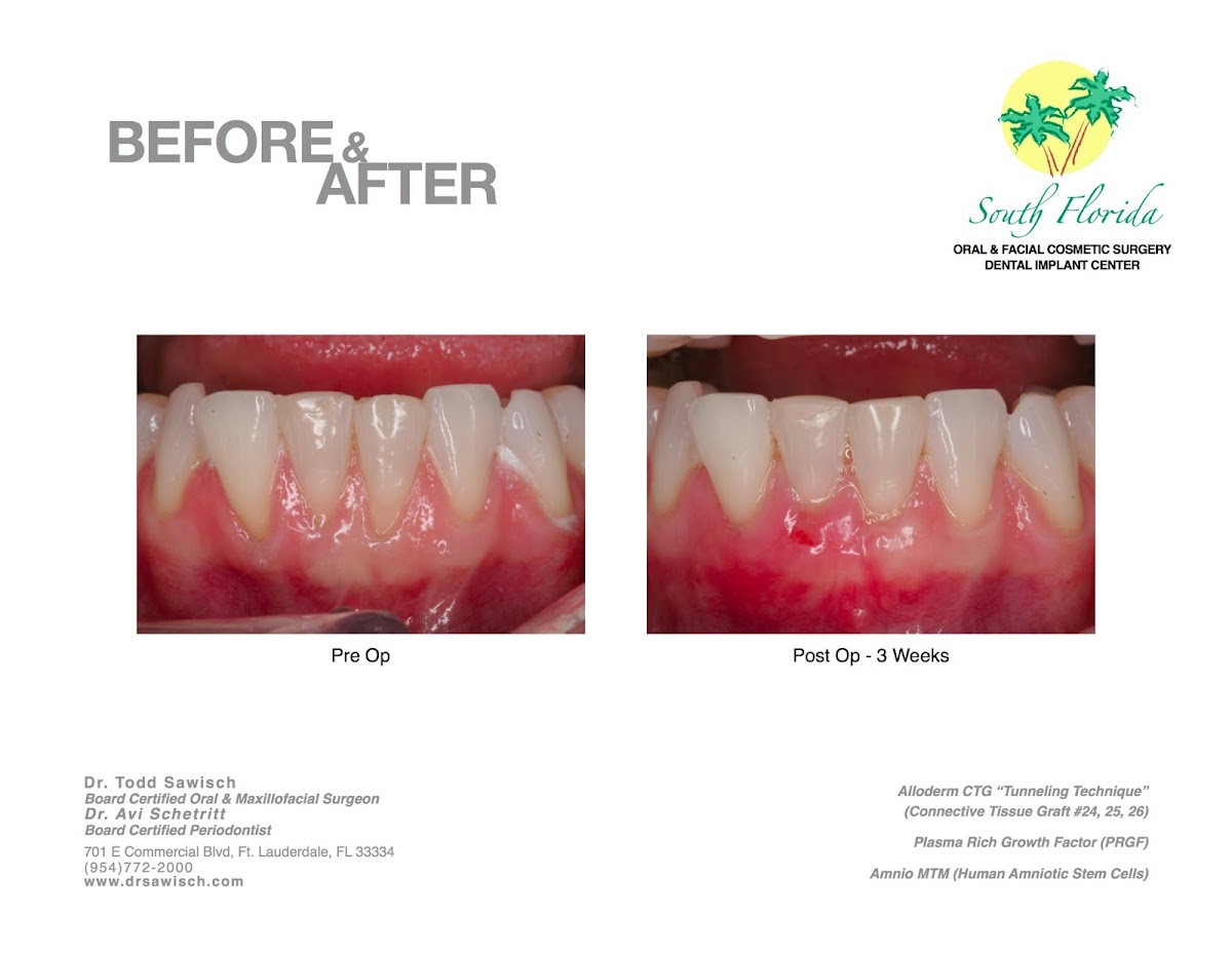 South Florida Oral & Facial Surgery | Dental Implant Center photo 5