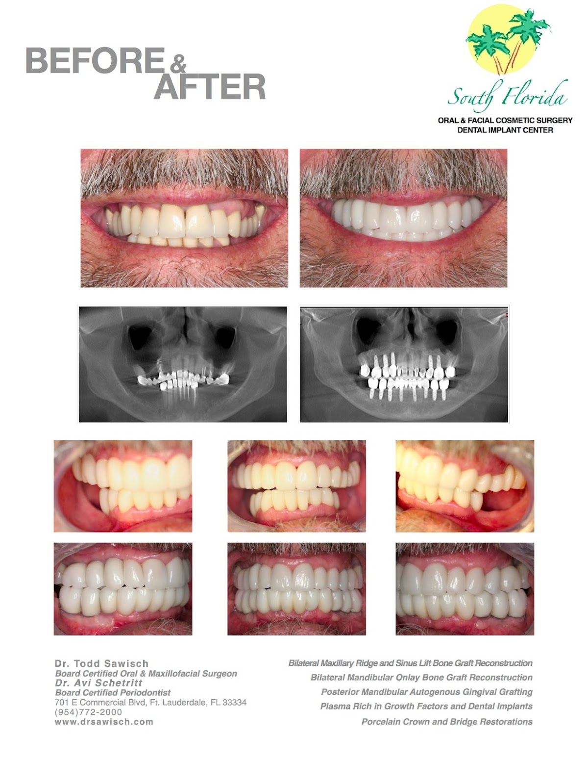 South Florida Oral & Facial Surgery | Dental Implant Center photo 6