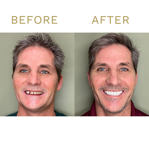 Tinley Park Smiles & Implant Dentistry photo 4