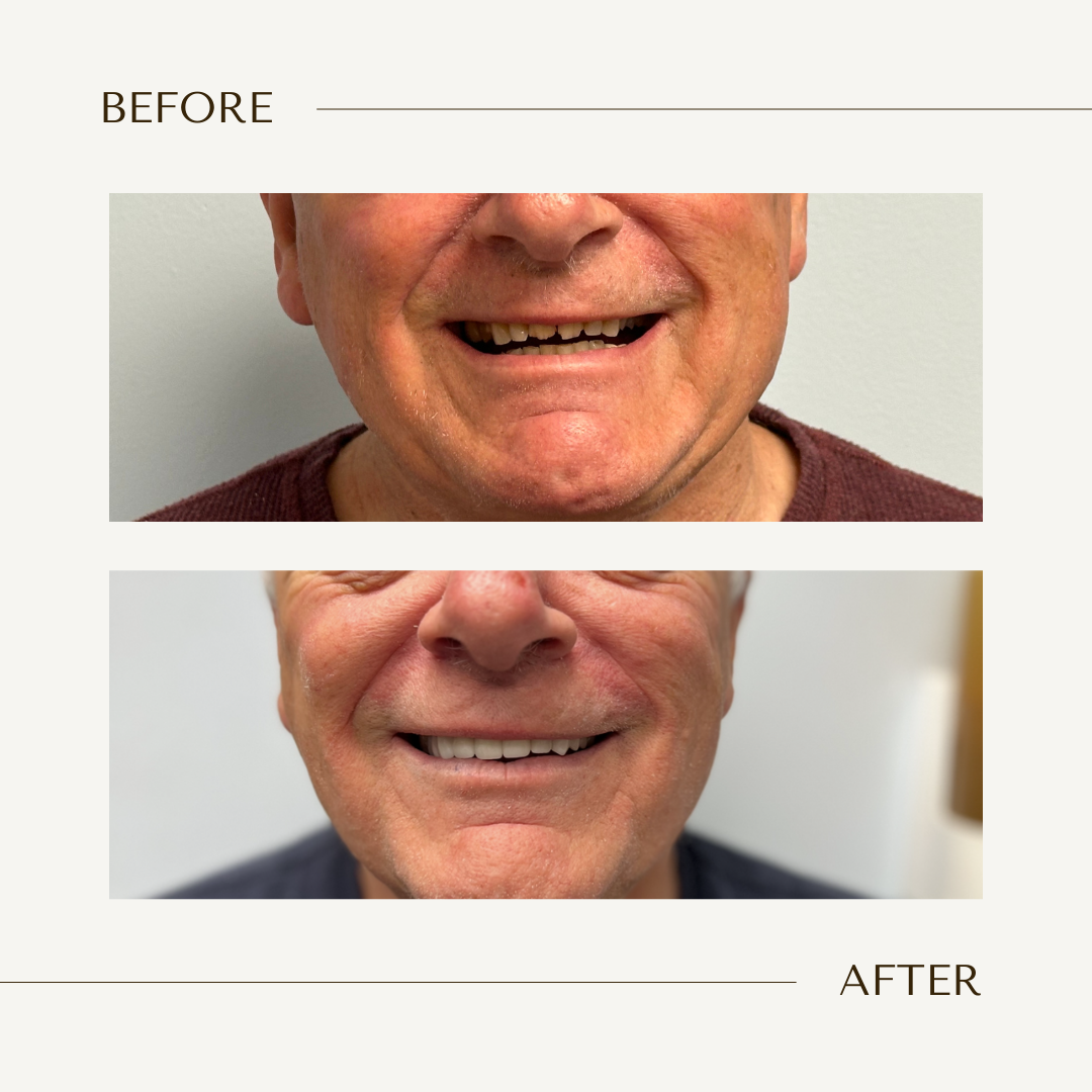 Tinley Park Smiles & Implant Dentistry photo 5