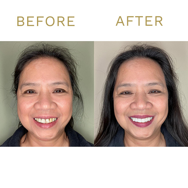 Tinley Park Smiles & Implant Dentistry photo 6