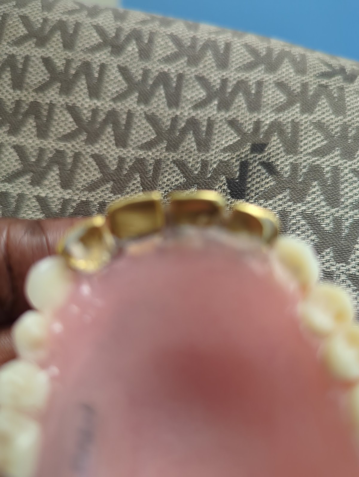 Affordable Dentures & Implants - Augusta photo 5