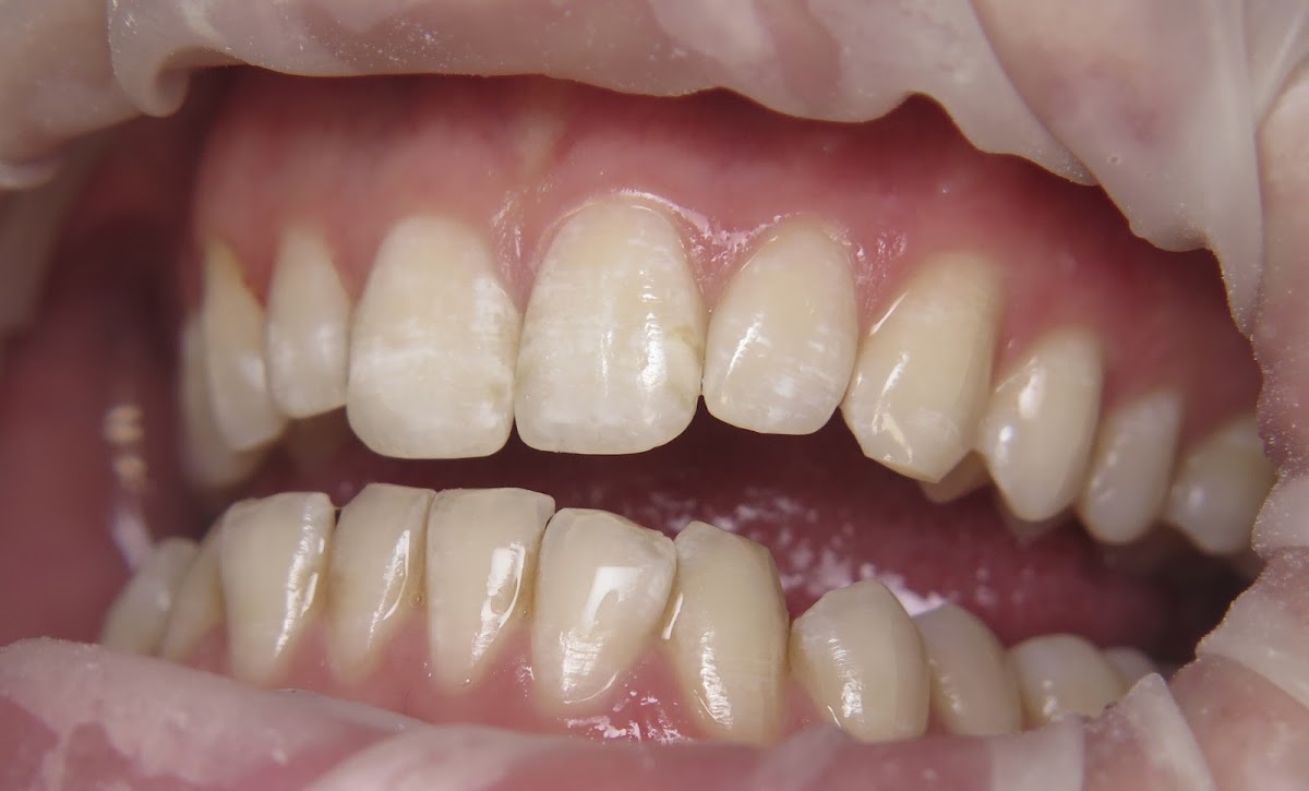Westlake Smile Design photo 4