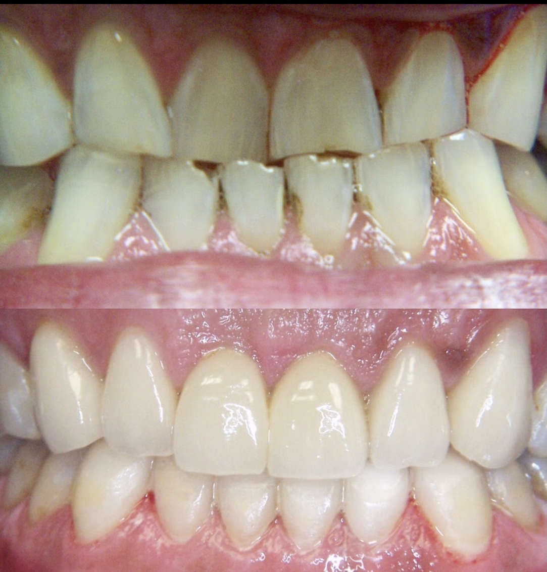 Everett Premier Dentistry: Sumit Makker D.D.S & Andrew Busev D.D.S. photo 2