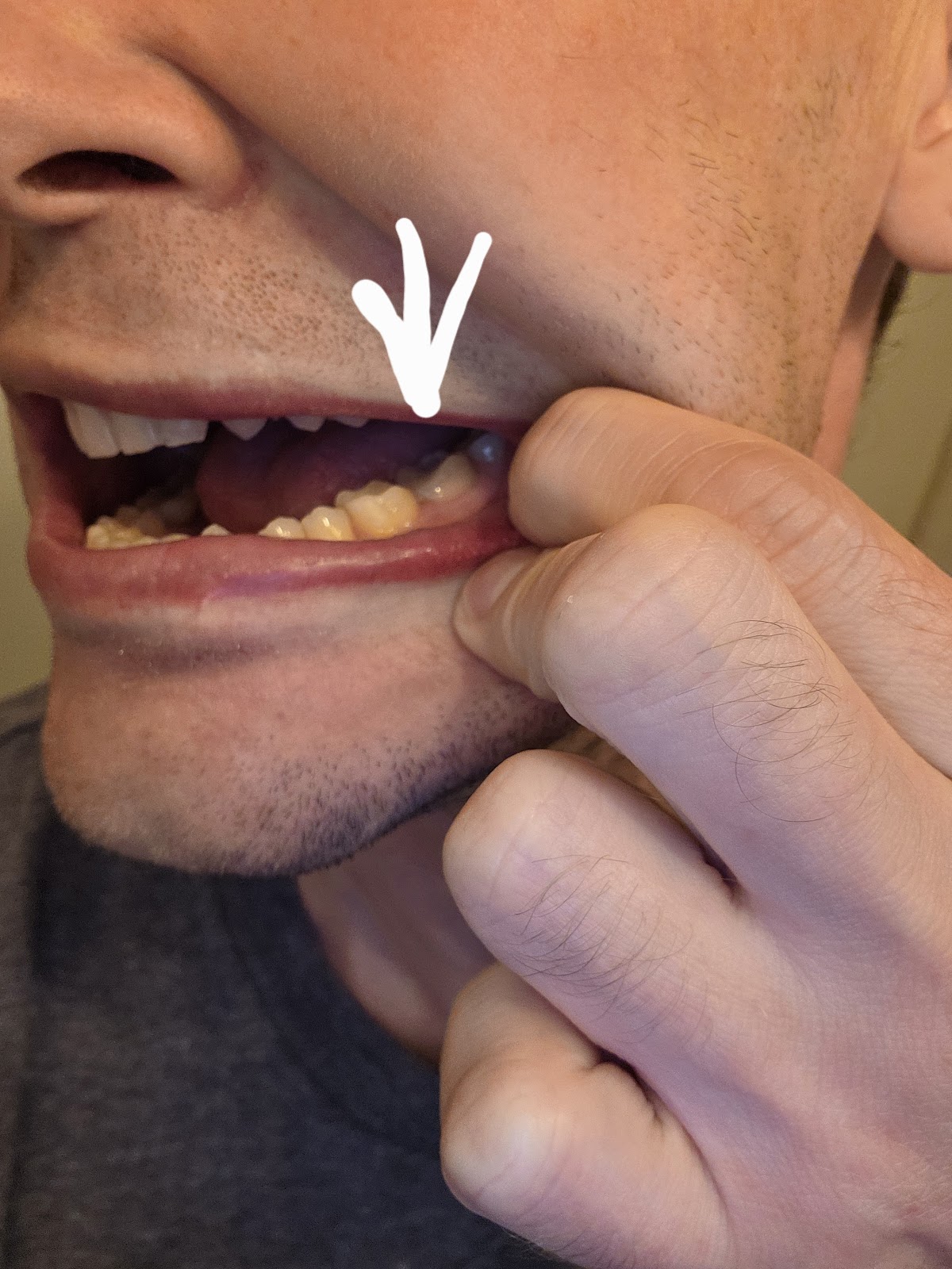 Everett Premier Dentistry: Sumit Makker D.D.S & Andrew Busev D.D.S. photo 6