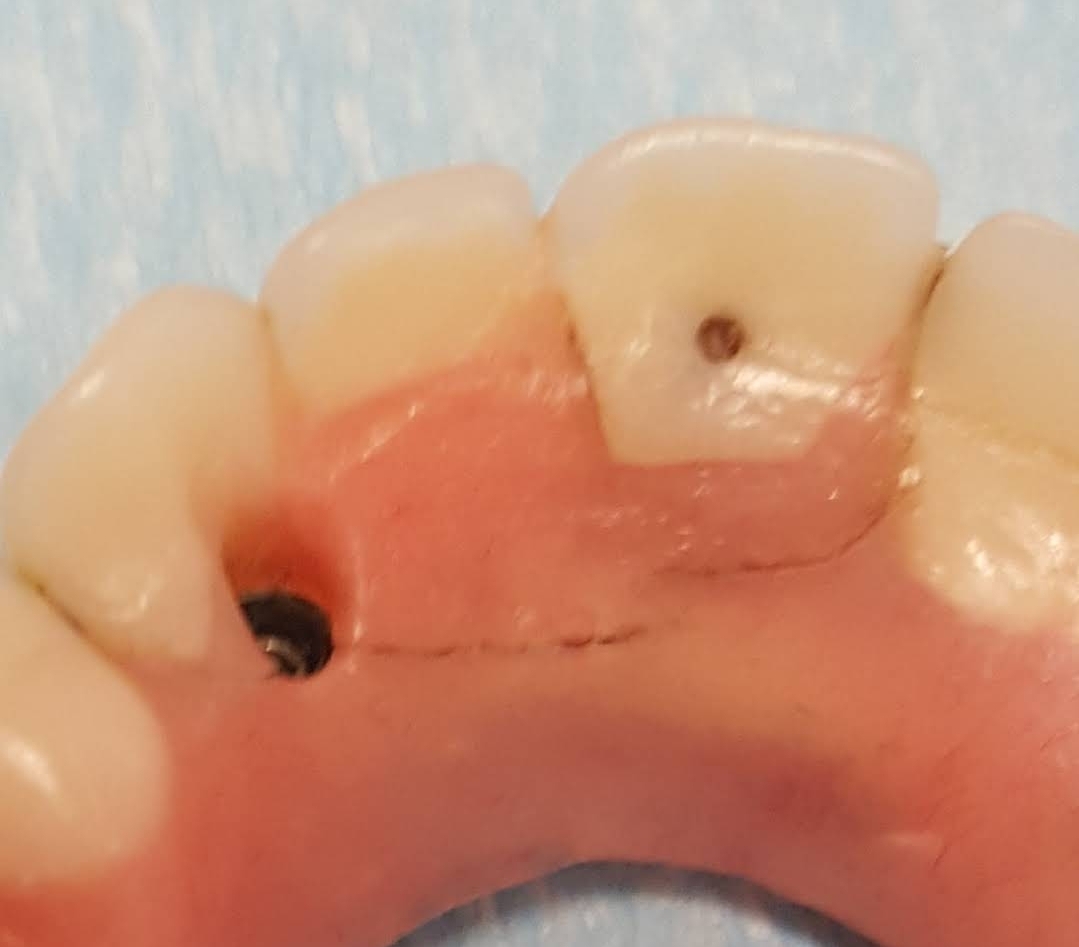 Clearchoice Dental Implant Center - Dallas photo 3