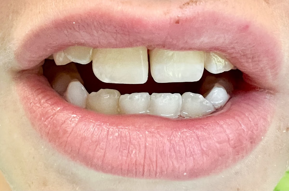 Grants Pass Smile Suite photo 2