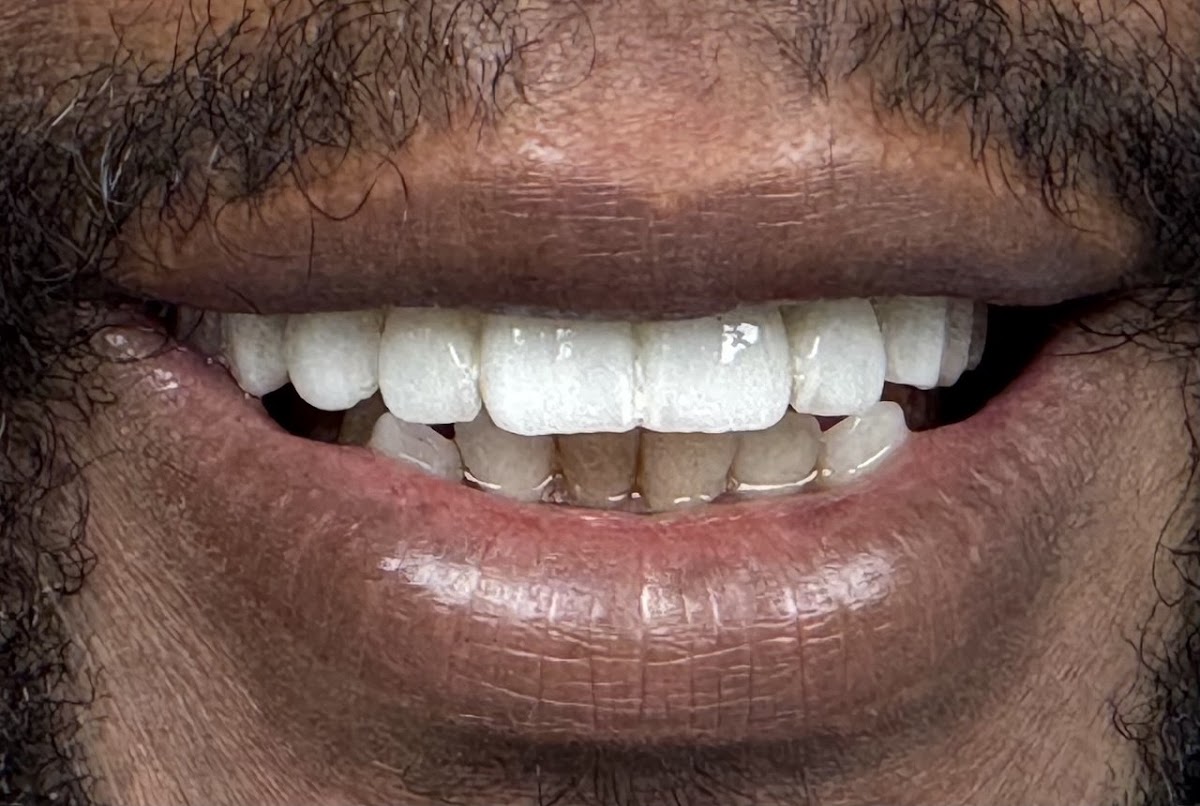 Advanced Dental Wellness Center photo 2