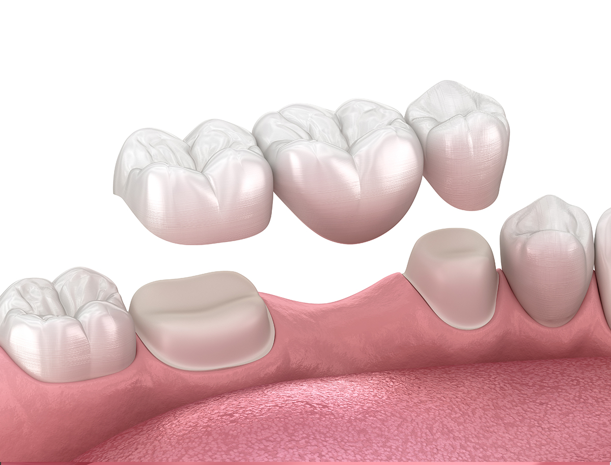 Dental Prosthodontics of Rochester photo 5