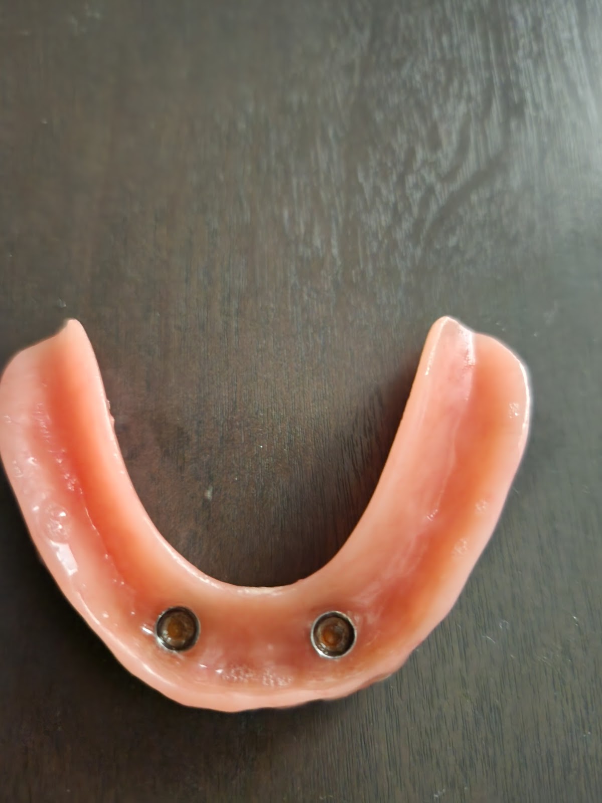 Aspen Dental - Arnold photo 4