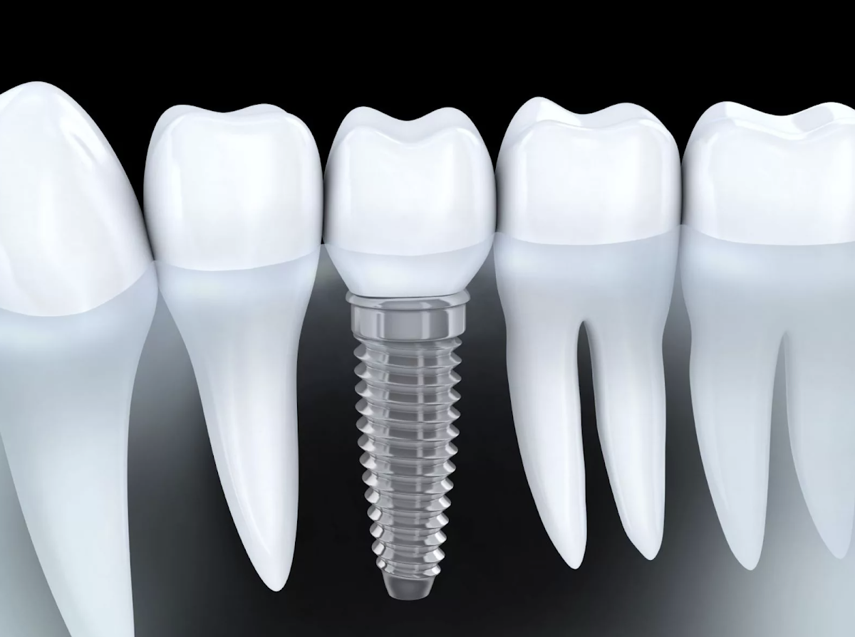 Affordable Dentistry of South Florida photo 5