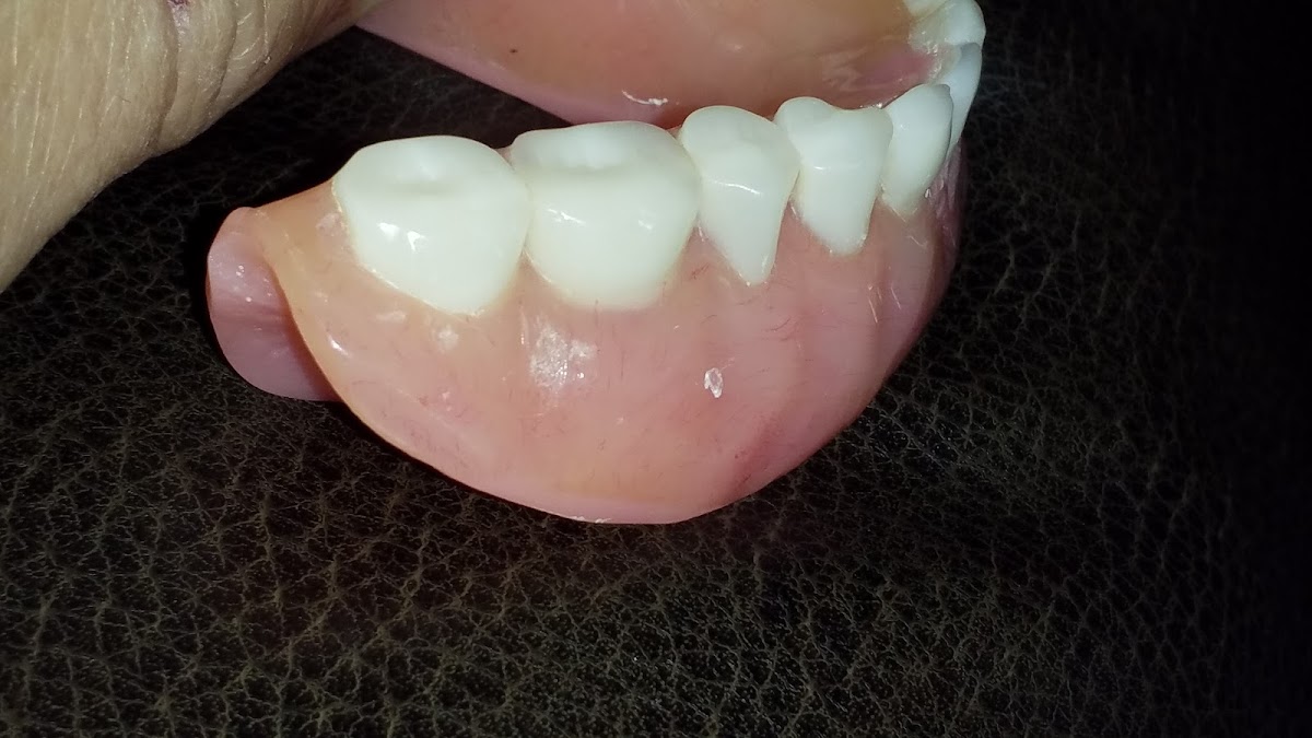 Aspen Dental - Branson photo 2