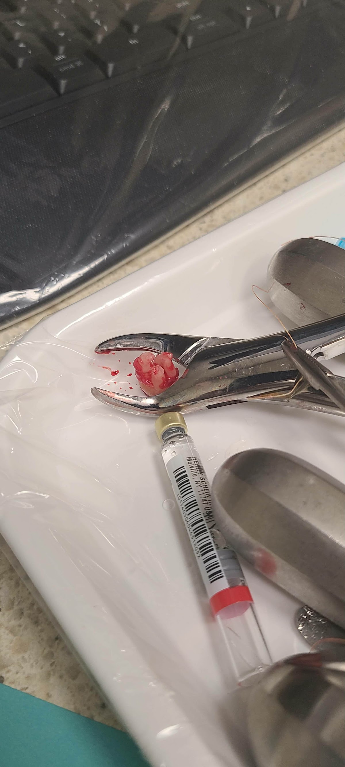Aspen Dental - Branson photo 5