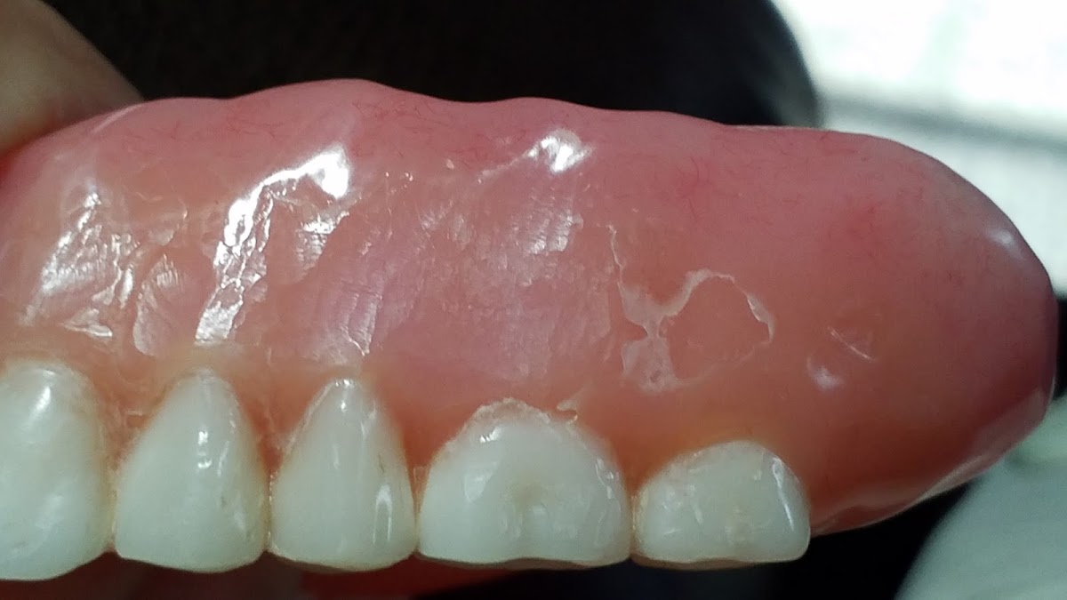 Aspen Dental - Branson photo 6