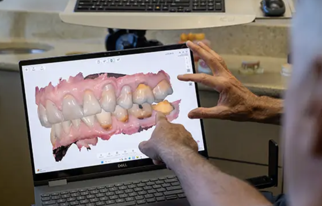 Dental Implant Center At Walnut Creek photo 6
