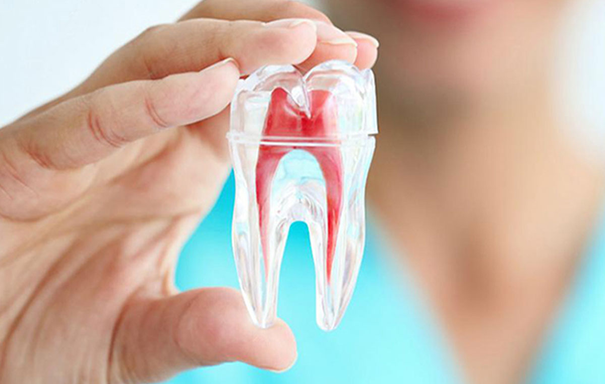 Brite Choice Dental El Monte - Cosmetic, Dental Implant & Family Dentistry photo 4