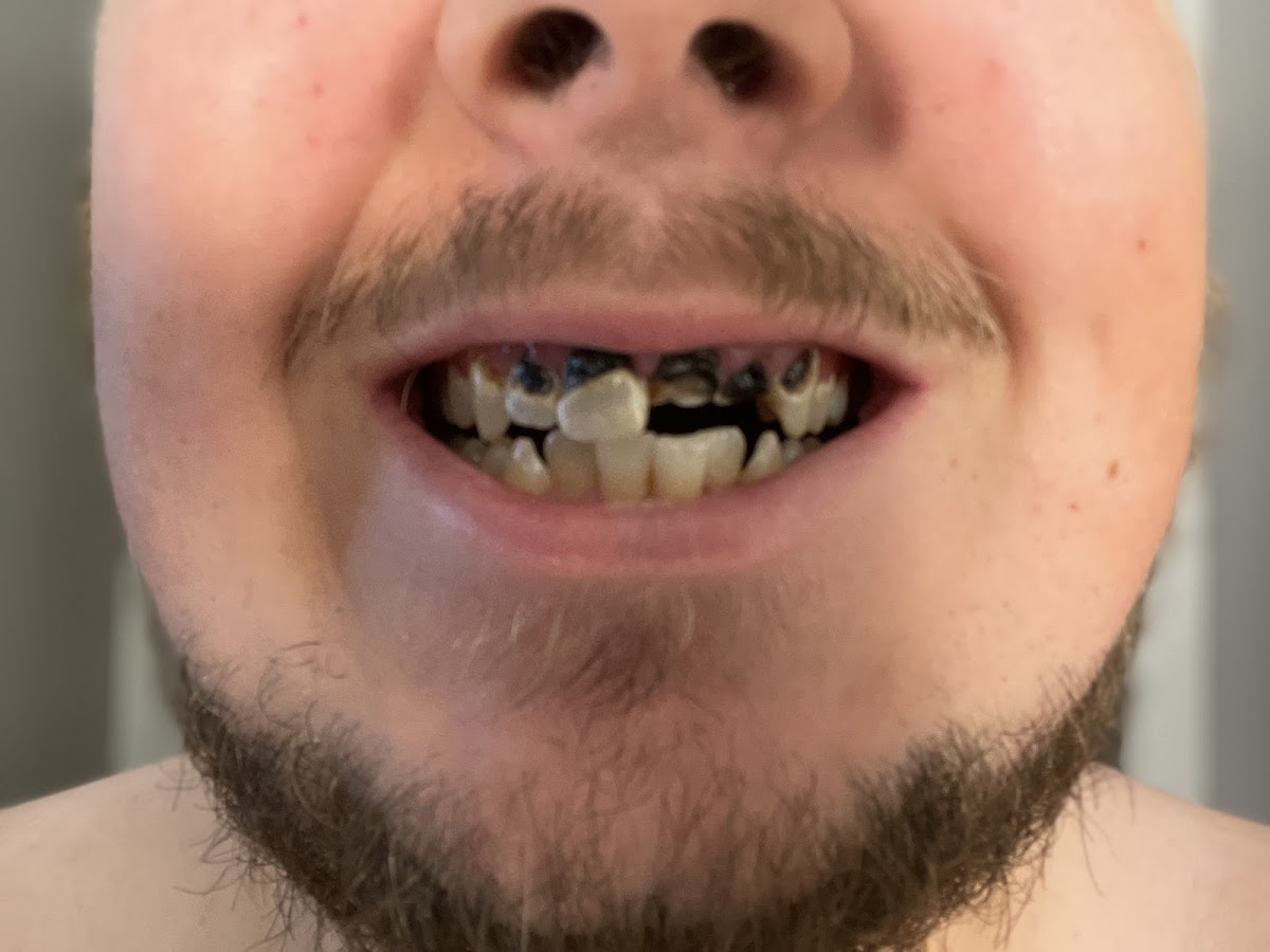 Aspen Dental - Springfield, Il photo 6