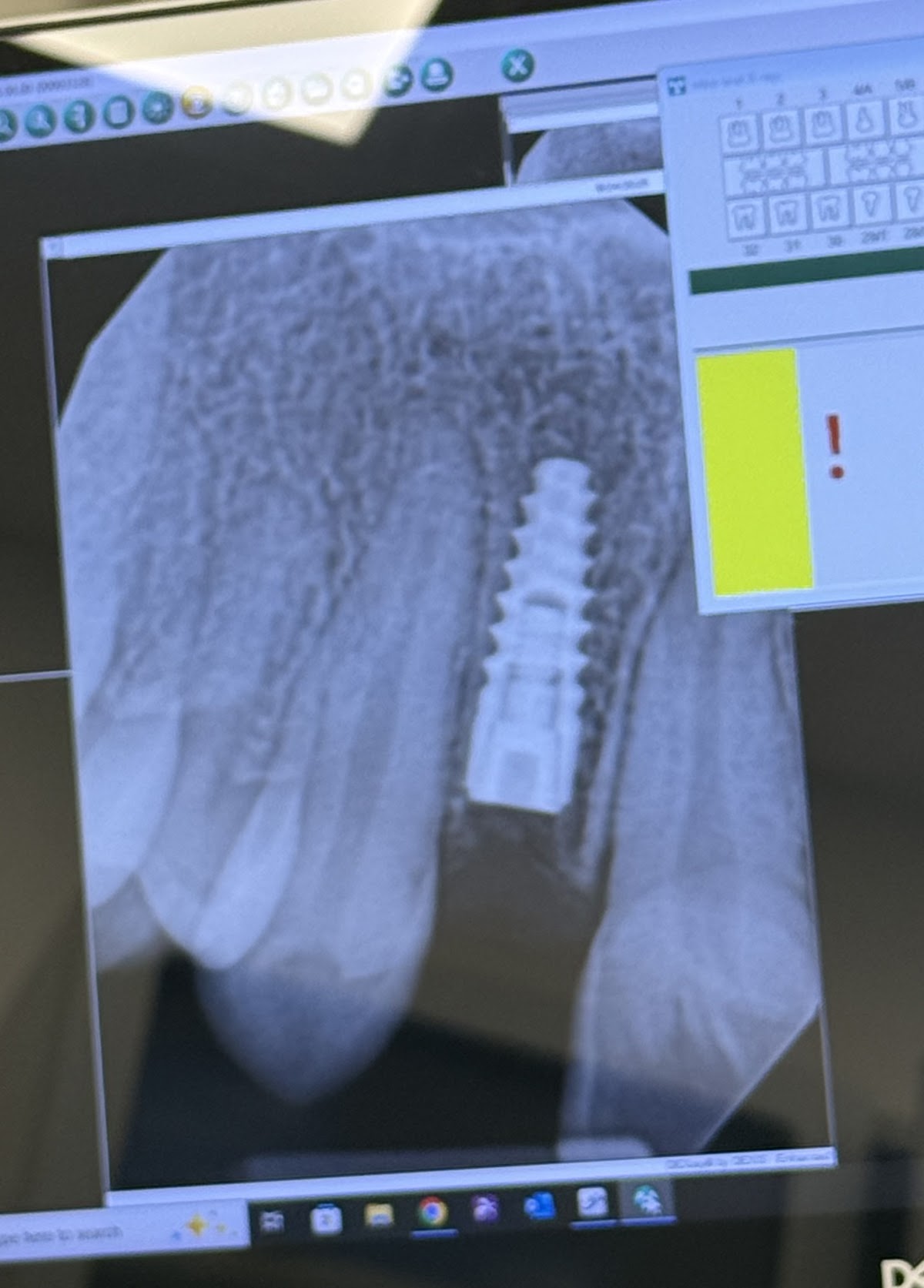 Perio Health & Dental Implants photo 1