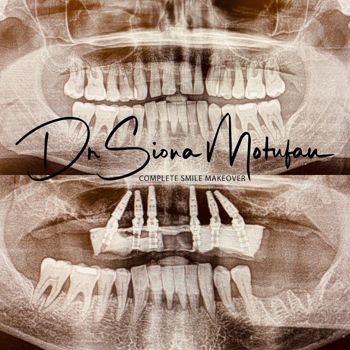 Ohana Dental Implant Centers photo 1
